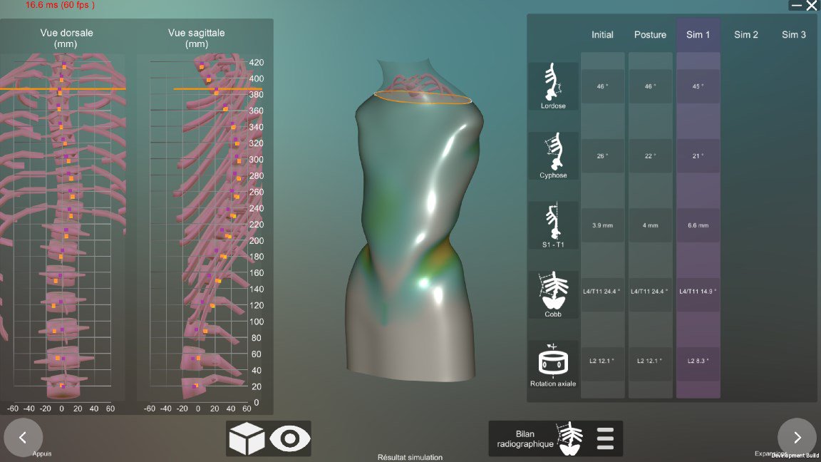 3DVTech's tweet photo. Le logiciel orthopédique Smartist dédié à la fabrication de corset de scoliose a été présenté au congrès annuel de la société française de chirurgie rachidienne SFCR. @3DVTech a travaillé avec @Proteor a son développement. https://t.co/EOdLR3UqTY