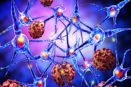 RareDR's tweet photo. #ICYMI: A neurosteroid developed by @MarinusPharma to prevent anti-seizure activity by calming the brain & restoring its electrical balance is being evaluated in children & young adults with #CDD in phase 3 #MarigoldStudy
https://t.co/OnVXMyPOlf https://t.co/IdxTPLyvNM