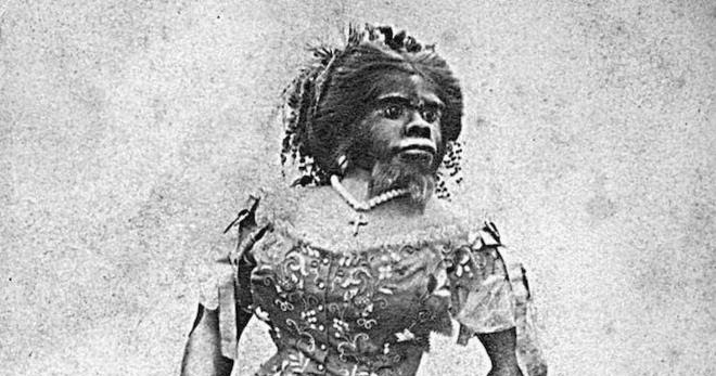 MagazineETH's tweet image. أقبح نساء العالم... زوجها تاجر بجثتها ودفنت بعد 150 عاماً !!!! dlvr.it/QcmmZ4