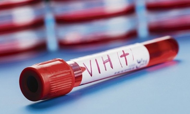 TvMax_Cable's tweet photo. #SALUD - Más de 80 jóvenes de entre 15 y 19 años, diagnosticados con VIH en 2017 -> https://t.co/R0F7NPQVt4.

Datos alarmantes. La principal causa es la falta de prevención y educación. A nivel general se detectaron 1.443 casos de VIH, según el Pronasida. https://t.co/kcErz2XbOi