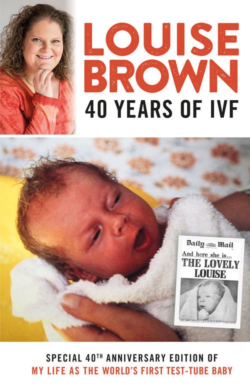 Louise Brown tweet media