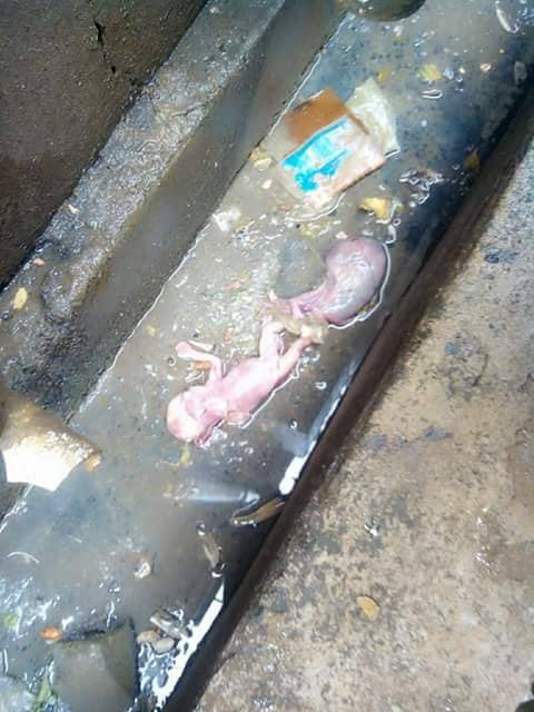 DrJohnAfam's tweet image. Just saw this and it breaks my heart!

Say no to Abortion!

Every Life is precious!

#Safereproductivehealth
#Safehealth 

We need to do a lot better!

We need to know about contraception!

We need to know about Safe Sex!

#DrJohnAfam