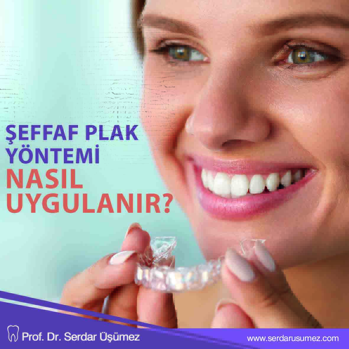 Şeffaf plak yöntemi uygulanırken, işe hastanın diş kalıbının alınmasıyla başlanır. Alınan diş kalıbı dijitalize edilir ya da dijital ağız içi kamera ile dişlerin görüntüsü çekilir. 
.
.
.
#serdarusumez #saglık #dis #dissaglıgı #health #teethhealth #ortodontik #Invisalign