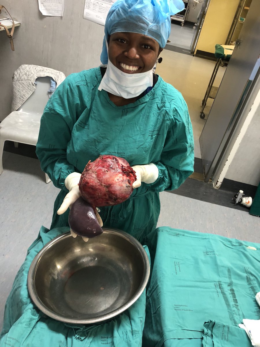 DrPhum's tweet image. Aaaand it’s out...👩🏾‍⚕️👑🔪🔪🔪 #Pancreaticneoplasms #splenectomy