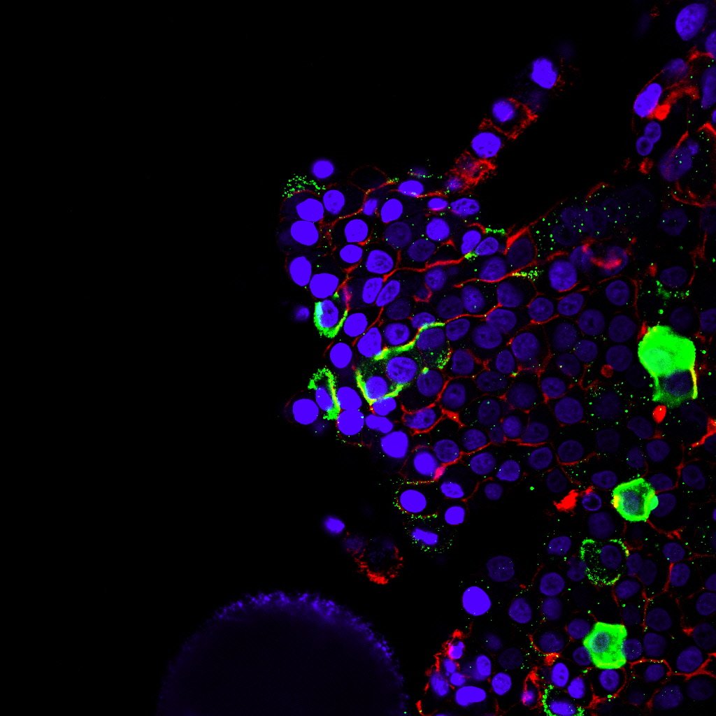officialatcc's tweet photo. Do your cell lines meet acceptable quality requirements for publishing a manuscript or applying for a grant? #ICLAC #celllineauthentication #STRProfiling #mycoplasma Check your cells before you wreck yourselves! Find out here: https://t.co/XEee0pKEeh https://t.co/NqZgqzjIWT