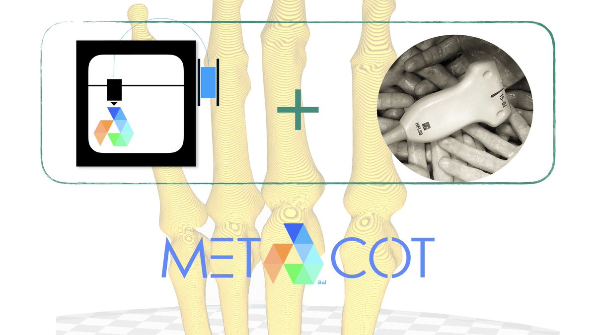 Preparando nuestra segunda entrada ... pronto más noticias .  #3d #impresion3d #ecografía #metacot3d #traumatologia