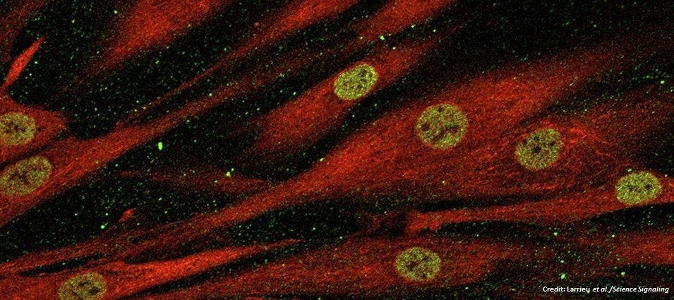 scisignal's tweet photo. Targeting NAT10 restores proper #NuclearImport in cells from HGPS patients @GurdonInstitute @CamCellMolBio #MechanismMatters https://t.co/oBymP03I1i https://t.co/0mnUBb2TjS
