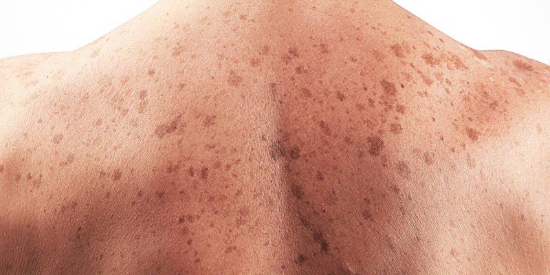 Cancer_Positivo's tweet photo. Científicos crean test que detecta el #cáncer de piel antes de que se expanda.
El nuevo método permitiría detectar mucho más rápido el melanoma, el #cáncer más agresivo que afecta a la piel.
https://t.co/uffDhYj9Gf https://t.co/WL5jTsbdvb