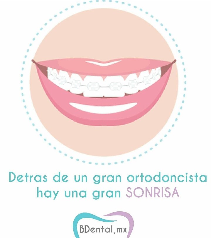 bdentalmx's tweet photo. El éxito es la suma de cada uno de los brakets corrigiendo una sonrisa 😁 #FelizJueves https://t.co/2EpfbOeCtp
