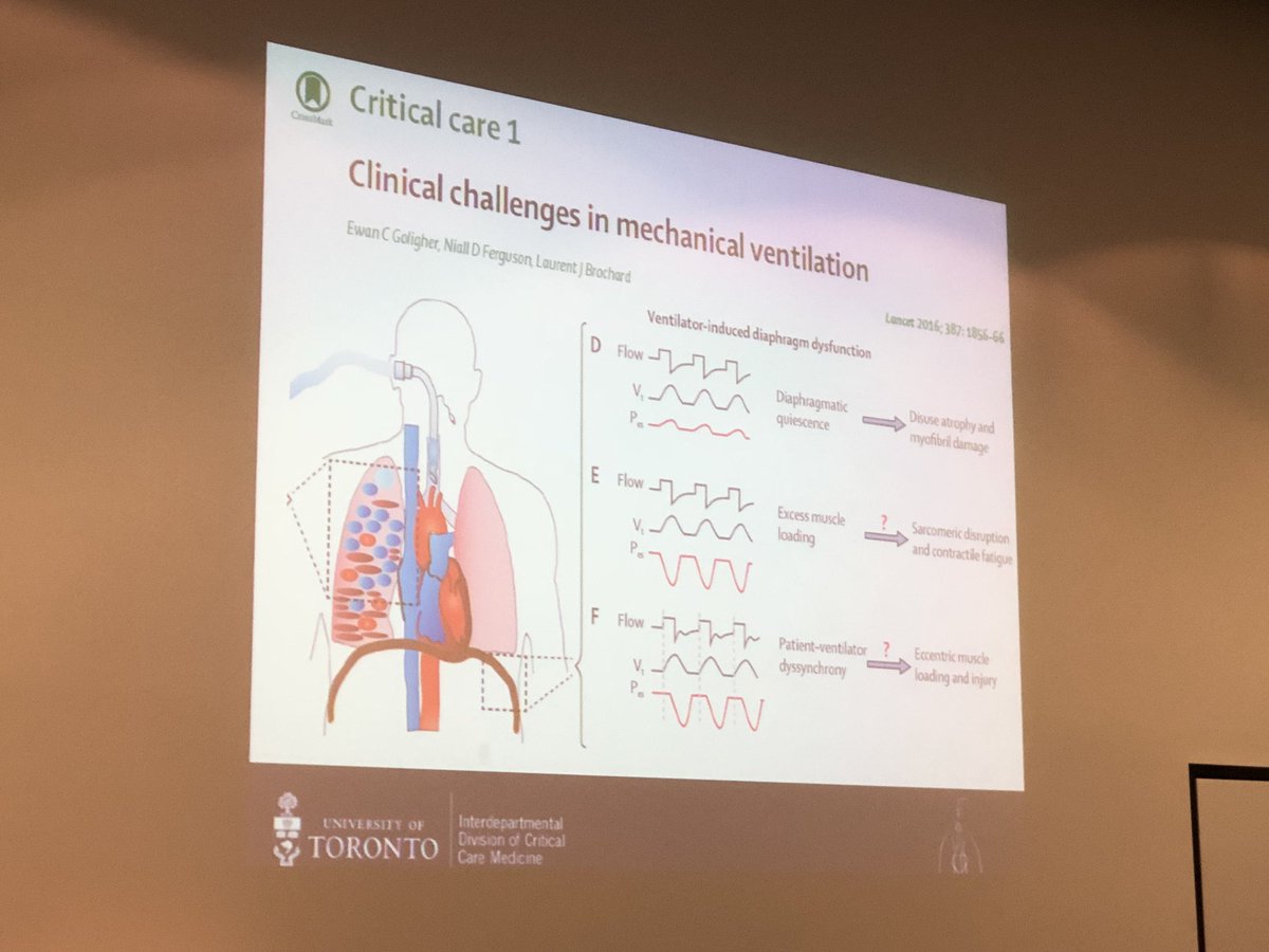 tomrollinsonPT's tweet photo. Prof Niall Ferguson “the diaphragm is never supposed to rest” #AAMVC2018 https://t.co/zmpa3Db889