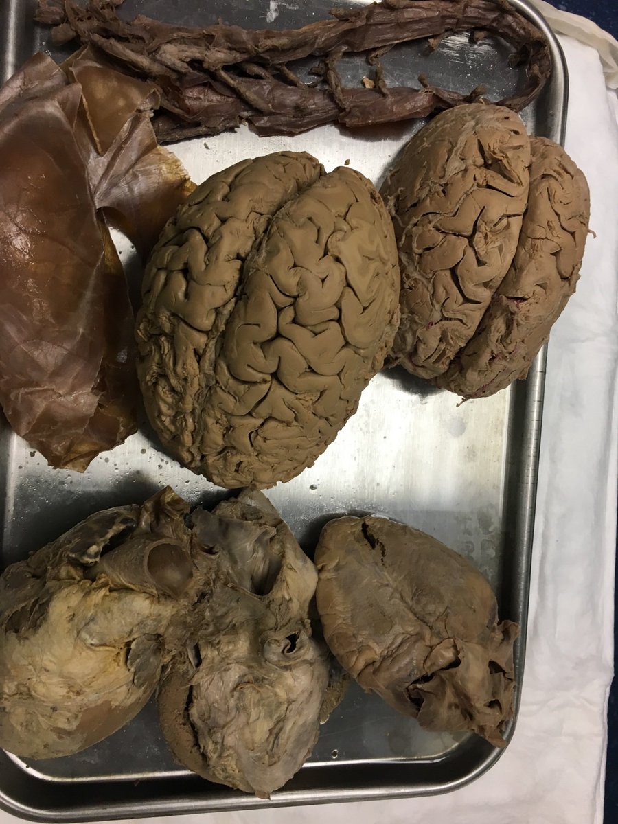 BMattCHS's tweet photo. Science nerd moment! Real cadaver organs at UK today!  #ClimbDeeper PLTW rocks!! https://t.co/N2rFNkgo4G