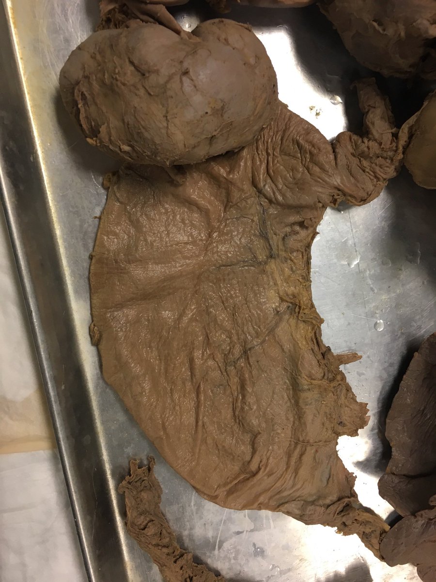 BMattCHS's tweet photo. Science nerd moment! Real cadaver organs at UK today!  #ClimbDeeper PLTW rocks!! https://t.co/N2rFNkgo4G