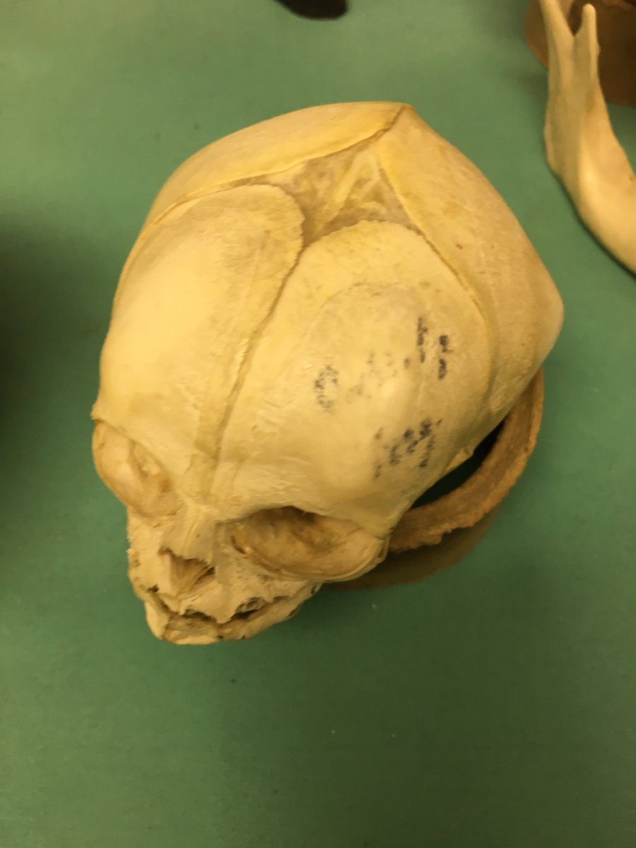 BMattCHS's tweet photo. Science nerd moment! Real cadaver organs at UK today!  #ClimbDeeper PLTW rocks!! https://t.co/N2rFNkgo4G