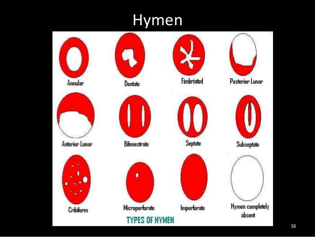 There are different types of hymen a girl can be born with (Check picture b...