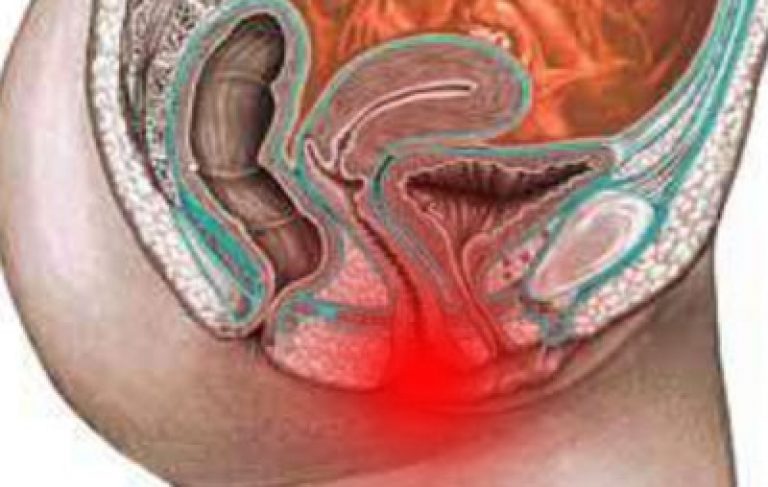 ���� ����� � ��������� ������ � pic 11