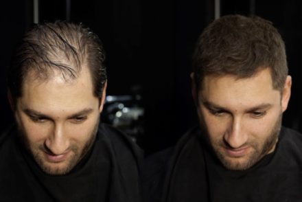 Check out #AskTheExpert on SLOAN! Magazine - Multi-award winning #hairdresser Jamie Stevens talks about #thinninghair, the reason behind #hairloss, how to slow it down &amp; how to help conceal it without having to have a #hairtransplant using <a href="/MRJAMIESTEVENS/">MR. JAMIE STEVENS</a> ift.tt/2LpfahV