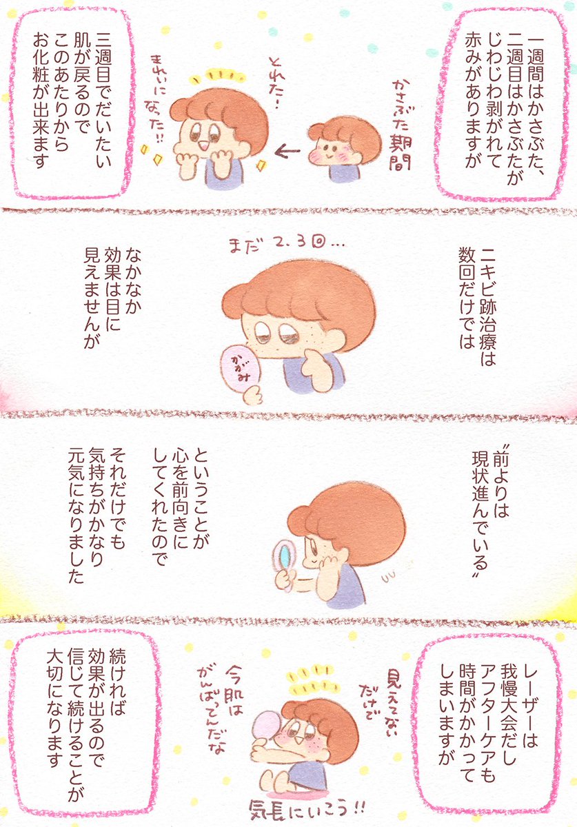 【ニキビ跡の治療方法とアフターケアと大事なポイントについて。その1】どんな治療かどんな感じか私がしている施術をざっくりまとめましたのでご興味のある方はどうぞ読んでみて下さい?