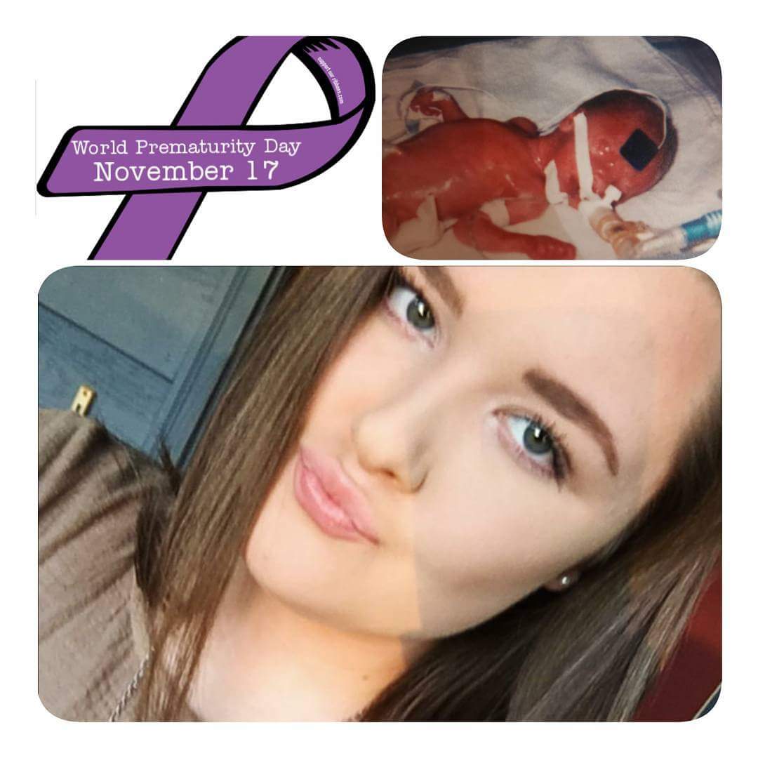 kristeallen's tweet photo. @RadioLunchbox Congratulations @RadioLunchbox! This is my daughter, Skylar. She was born 12 weeks early weighing 2 lbs 4.5 ounces. She spent 2 months in the NICU. Today she is a HEALTHY, happy 16 year old. Hang in there! Your baby will be home with you guys soon! Prayers... 🙏 https://t.co/nyorP1icXD