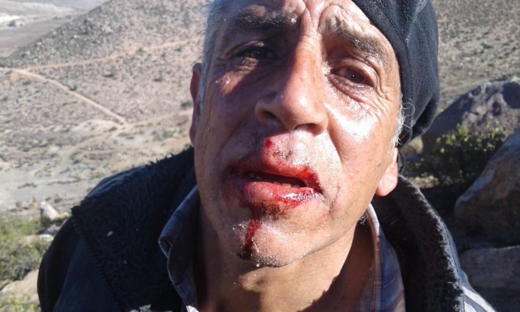 Erick Zelada tweet media