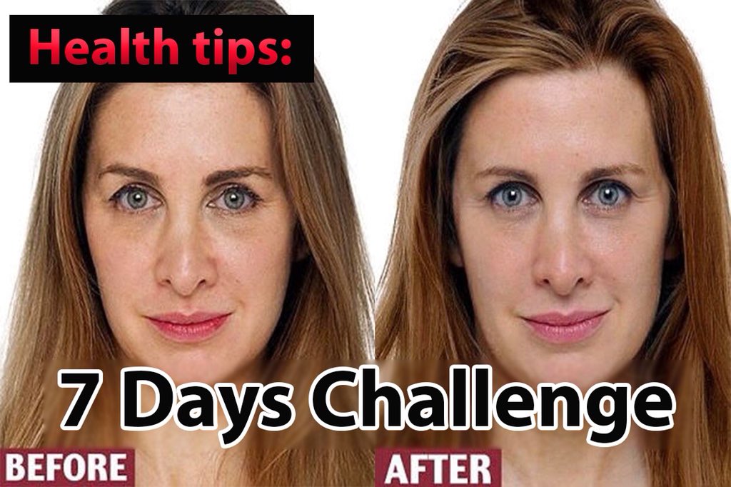 AspirersGroup's tweet photo. 100% Natural | Home Remedy | Better Skin in 7 Days | Collagen | Skin Health 

https://t.co/NfYjAmxRYn 

#NoConfidenceMotion #السبت_عوده_العمالقه #Biggbosstamil #viswasam #sarkar #RahulHugsModi #HBDSuriyaCDP #GoldJukebox #BoBTurns111 #BiggBossTamil2 #biggbossmalayalam https://t.co/pyiezhZfga