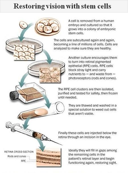 StemCellCong's tweet image. #stemcells instead of Retinal Tissues?? A new research states- To know more:goo.gl/rNr322