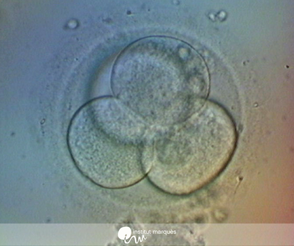 imarques_EN's tweet photo. After an #IVF cycle, embryos can be transferred fresh or they can be frozen and transferred in a later cycle, what we call a delayed frozen embryo transfer. Which option is best? Dr. López-Teijón shares her expertise on this issue on #FertilityExperiences. https://t.co/BVISiTB2d5 https://t.co/iwtfRbvXMj