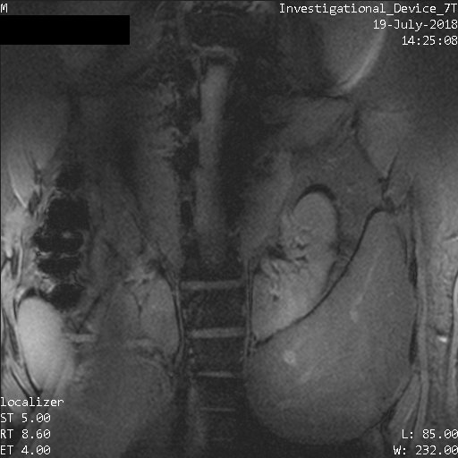 BMEIIsinai's tweet photo. First human body images off the @IcahnMountSinai #7TMRI. @tmiinyc cv, spinal cord, liver &amp; prostate #MRI taken to the next level #engineeringtomorrow This new #PTxBodyCoil is hopefully the 1st of many collaborations btwn #LifeServicesLLC &amp; #BalchandaniLab @BachirTaouli @zahifayad https://t.co/b2JYIdS4CU