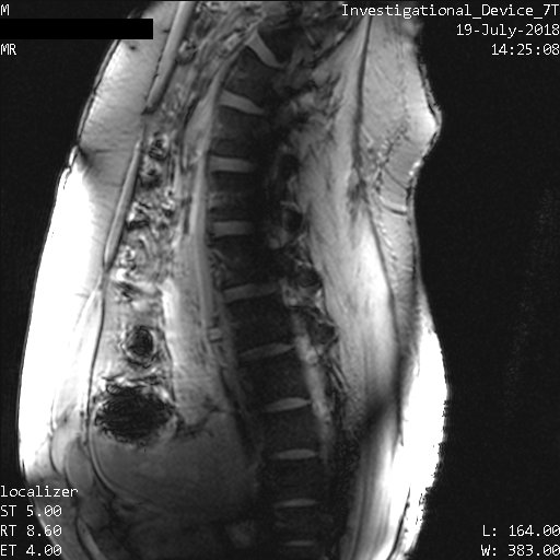 BMEIIsinai's tweet photo. First human body images off the @IcahnMountSinai #7TMRI. @tmiinyc cv, spinal cord, liver &amp; prostate #MRI taken to the next level #engineeringtomorrow This new #PTxBodyCoil is hopefully the 1st of many collaborations btwn #LifeServicesLLC &amp; #BalchandaniLab @BachirTaouli @zahifayad https://t.co/b2JYIdS4CU