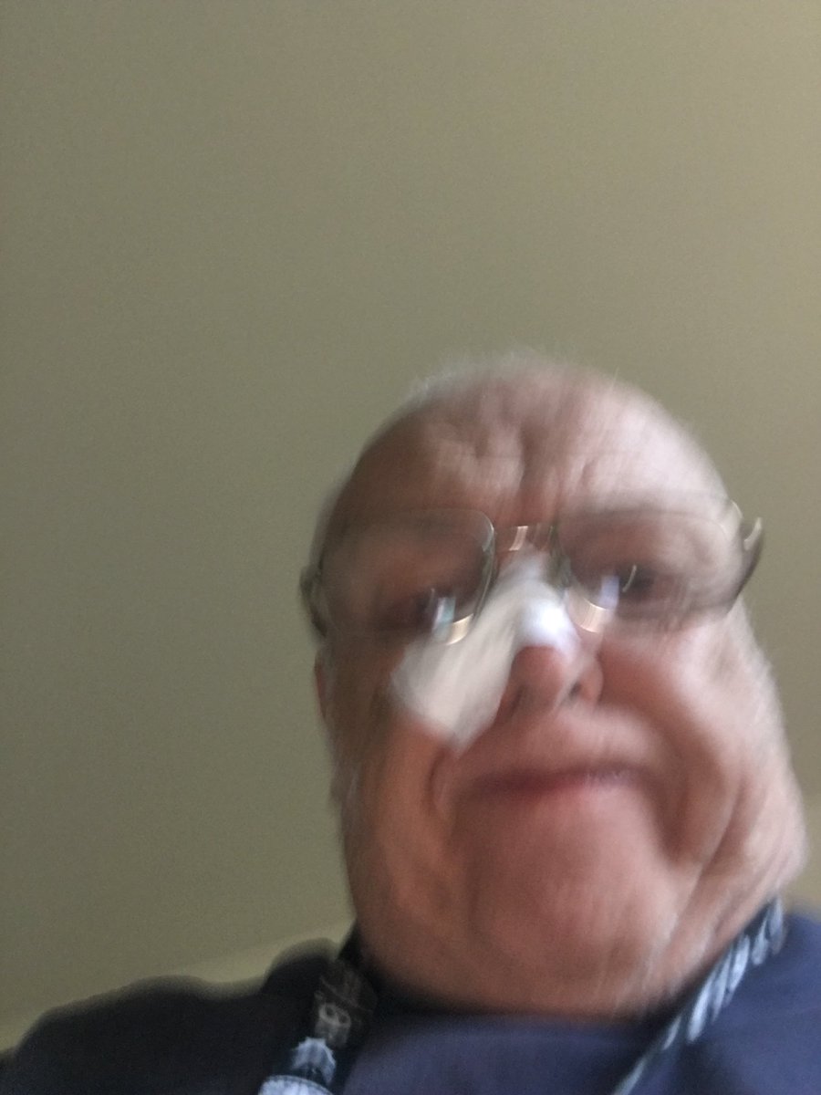 kevdor79's tweet photo. They remove skin cancer from my face today https://t.co/YIbZD2oijL