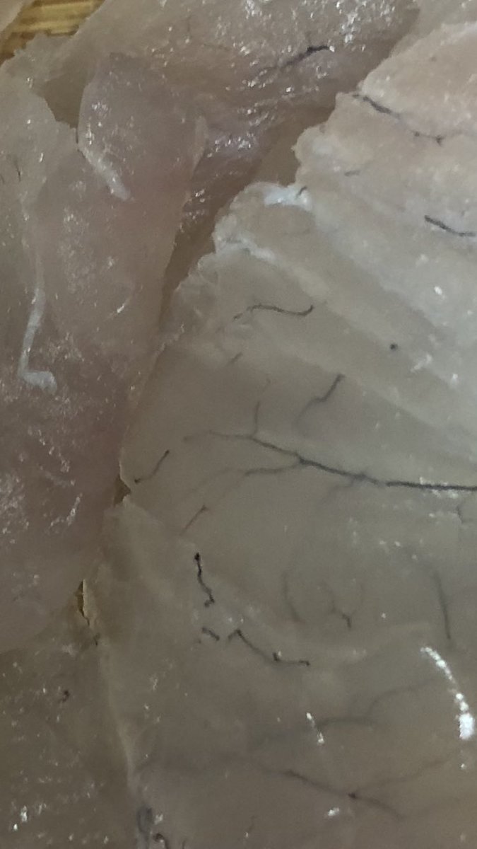 まりのすけ A Twitter 若干グロ注意 鯛をお刺身にしてたら何かいつもと違う違和感が 黒い線みたいなのは何ですかね 食べれます T Co Eqitn2kt8f Twitter