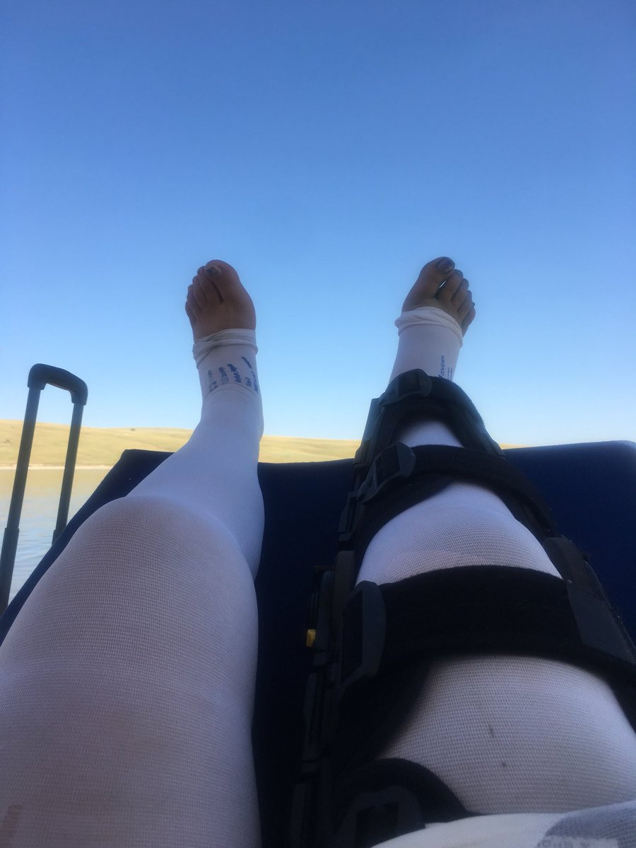 Country_Diva's tweet photo. Who invented #tedhose I mean I understand they are important for blood clots but honestly they are my least favorite thing right now. #fracturedTibia #brokengirlproblems https://t.co/J3ECSVEKWD