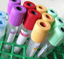 CockerWarren's tweet photo. Spent my afternoon yday supporting a lady, with an LD, who fears needles. Together, we were able to take blood samples from her as well as complete an ECG! Hoping to get normal results back. Big thanks to team at @DanshellGroup! #unlockingequality https://t.co/wSvEIsAIy0