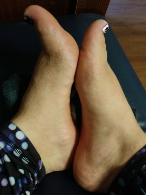 Imprints left from my socks lol #feet #FootFetish https://t.co/l3jhbynNHw<a href="/tag/feet"class="tags">#feet</a><a href="/tag/footfetish"class="tags">#FootFetish</a>