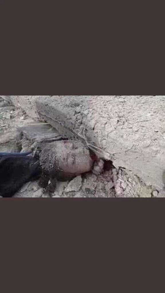 #احكيني_عن_طفولتك
حكاية أطفال اليمن مأساوية،يكتبها بالدم