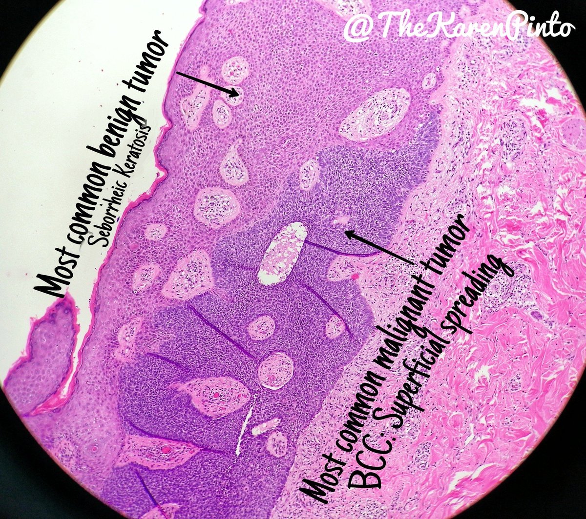 Karen Pinto DNB, FRCPath tweet media