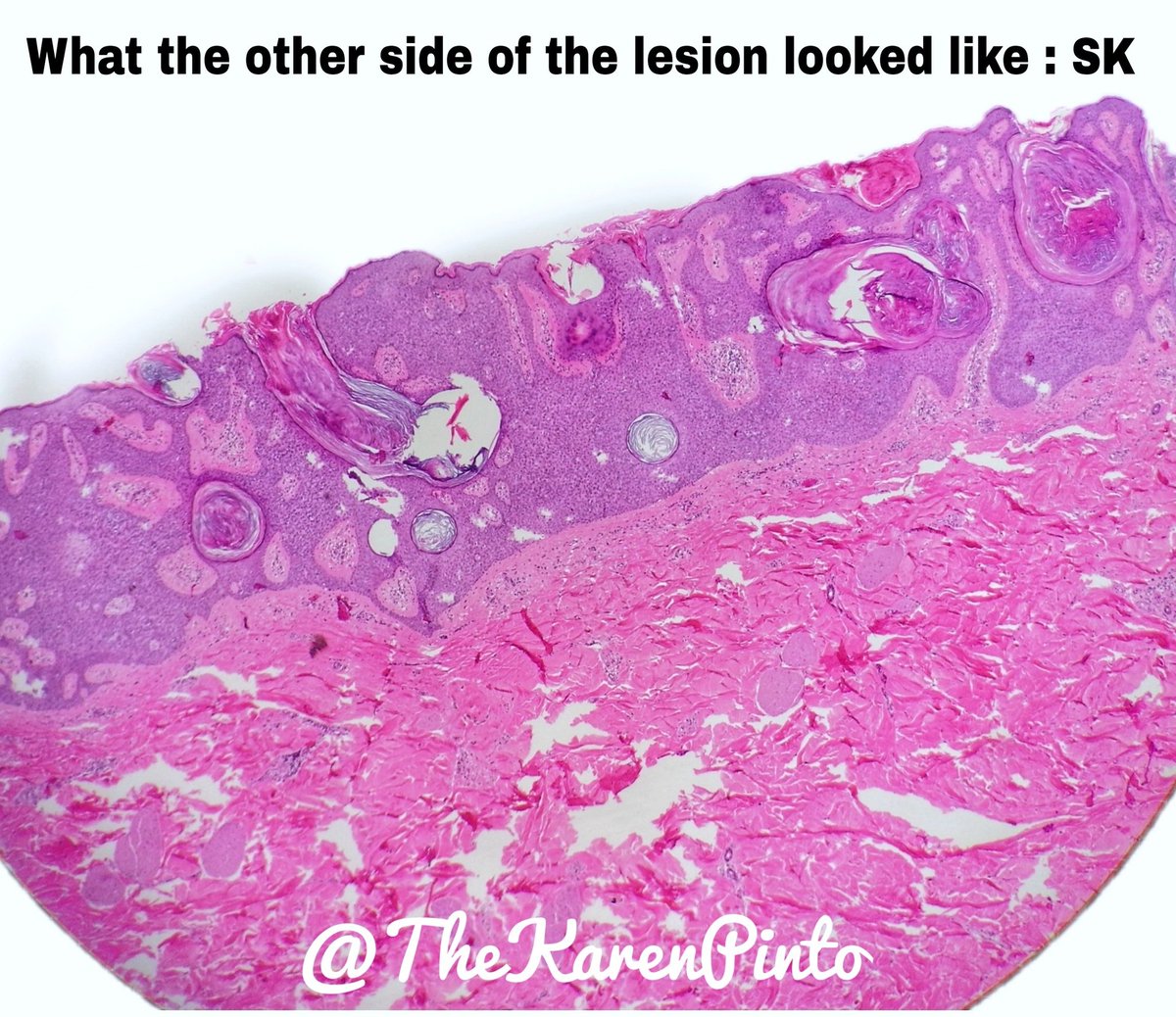 Karen Pinto DNB, FRCPath tweet media