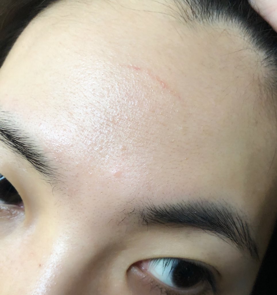 東内マリ子 今朝起きたら額に一筋の傷が出来てたのでゆくゆくは第三の目が開眼するかもです 世界一いらない報告をする見た人もやる 東内マリ子 今朝起きたら額に一筋の傷が出来てたのでゆくゆくは第三の目が開眼するかもです 世界一いらない報告をする見た人もやる