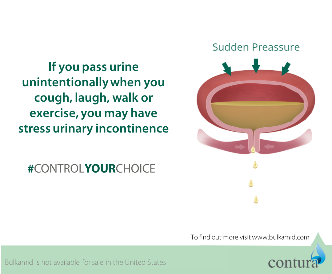 Contura_Intern's tweet photo. If you pass urine unintentionally when you cough, laugh, walk or exercise, you may have stress urinary incontinence (SUI). Learn more about SUI by watching our simple animation at https://t.co/nzdLt2uPM9
#controlyourchoice #stressincontinence #urethralbulking https://t.co/2uZb0WCMMt