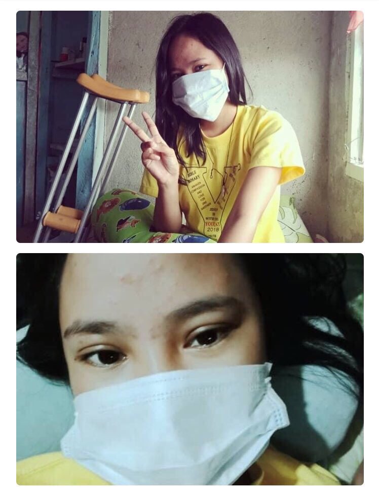 klintsamonte's tweet photo. It could happen to anyone. Unfortunately, it happened to her now at age 20. She can #WinAgainstCancer if we help her in this battle. So please do DONATE and retweet this. 🙏

GoFundMe: https://t.co/PbCnTknr1i
LandBank: ACCT NAME - Angelica C. Cañete. ACCT NO. - SA 2176183783 https://t.co/6CvN2WRV43