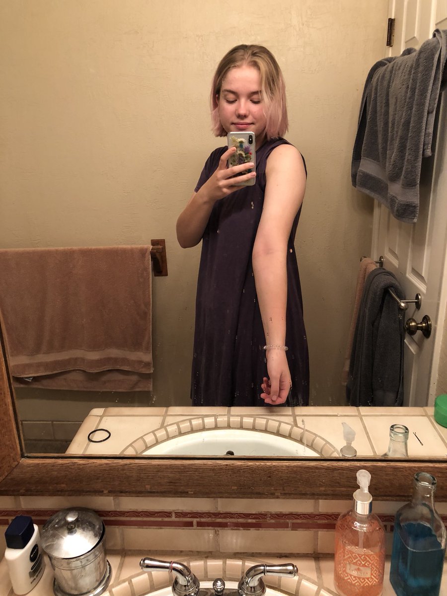 juli_lee42's tweet photo. I’ve now been on @HaloBeauty for a few months, and it has done absolute wonders for my eczema. The first two pictures are what I sent my dr to ask to be put back on oral steroids. The next are of me, steroid free after 3-4 months of Halo ���� @tatiwestbrook https://t.co/biSEu8jaIl