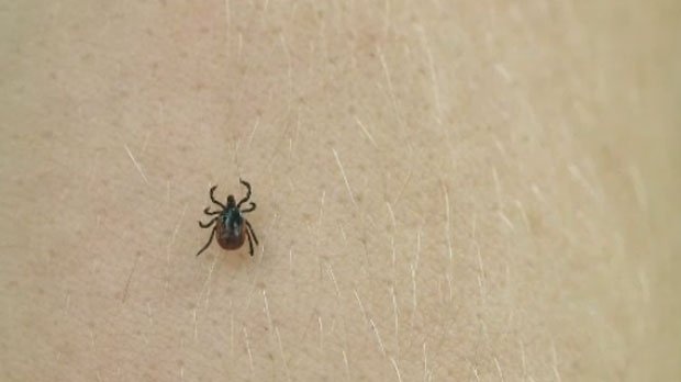 CTVMontreal's tweet photo. Pharmacists now able to administer antibiotics for Lyme Disease https://t.co/LxRTu9C4bG https://t.co/RWVa84E7sm