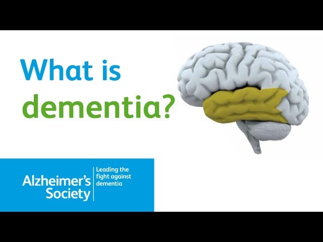 What is #dementia? 

The symptoms of dementia are caused by several different diseases that affect the brain.

For more about #dementia, check out the link below to the Alzheimers Society website full of key information &amp; resources

ow.ly/AoXr30l0Ar1