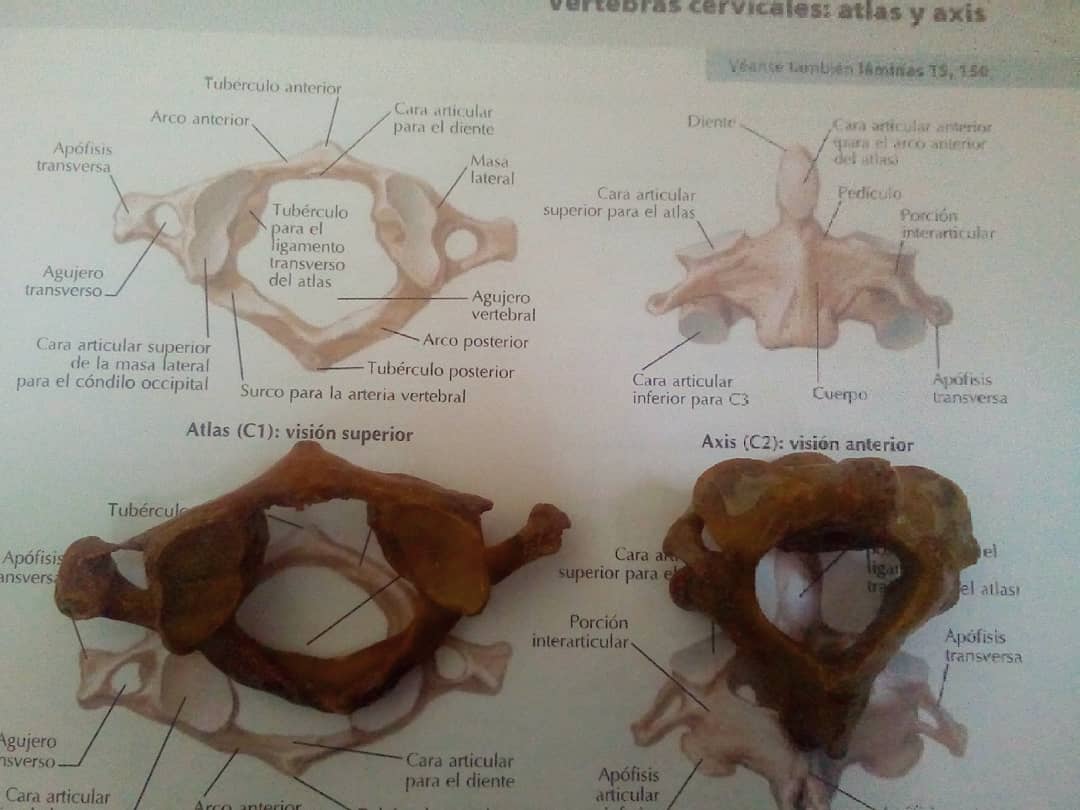 hguadron9's tweet photo. Primera y segunda vértebra cervical, atlas y axis. #anatomiahumana #foues 
Què bonito es lo bonito. https://t.co/oV642t1e2N