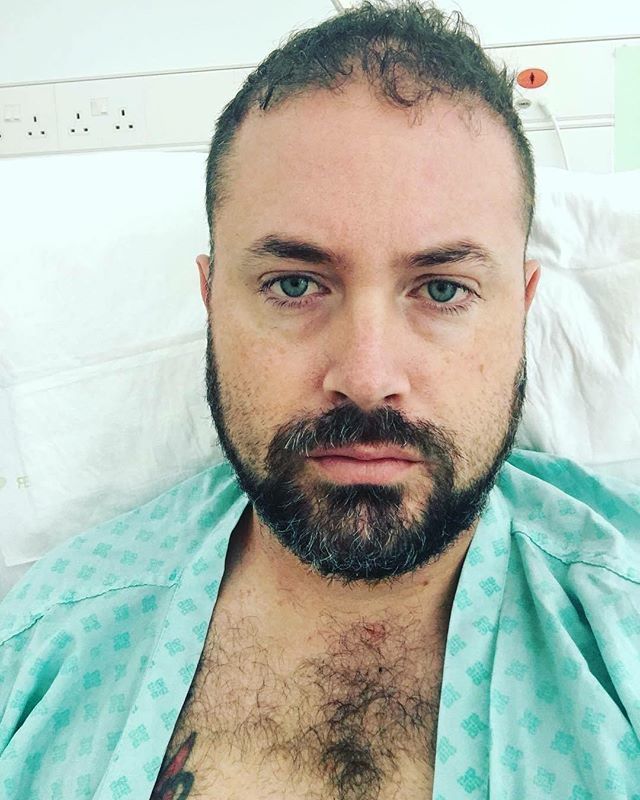 A year ago today, I woke up from my 3rd brain surgery within a 5 day period! What a year it’s been too! @braintumourrsch @wessexcancertrust @ouhospitals ift.tt/2uJhM0F