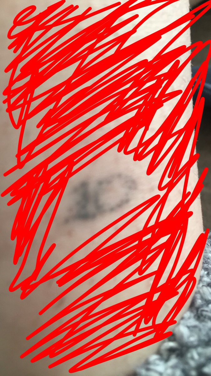 niallersjbieber's tweet image. If you’re ever upset, just know when I was drunk; someone wrote ‘1D’ on my ankle with needle and ink but it looks like a 10. It’s been like this since the end of last year. 
#8YearsWithOneDirection