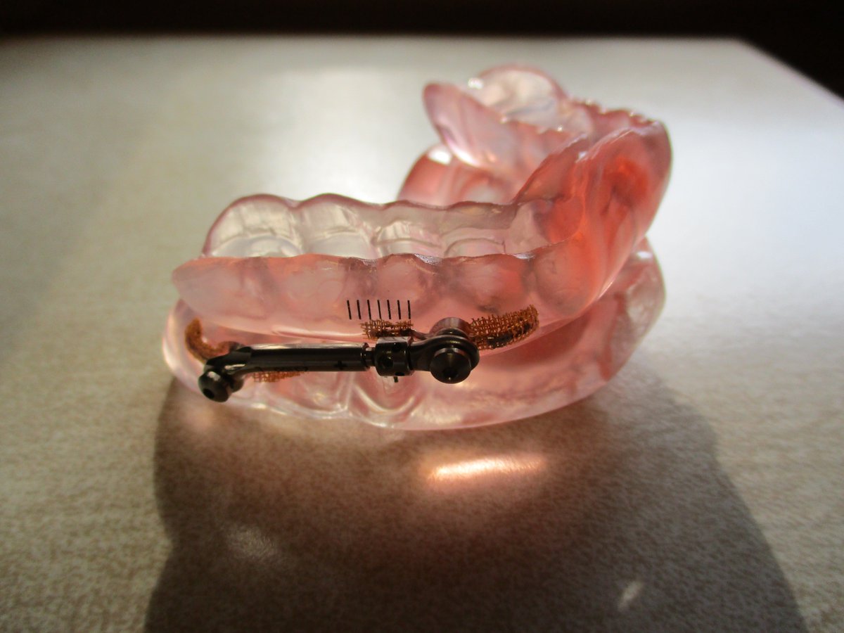 UnitySleepWell's tweet image. Effective, FDA approved treatment for sleep apnea. No CPAP required. Contact @HeathDentistry , Free screenings. Feel years younger with more energy &amp;amp; improved memory all while reducing your risk of chronic disease. We work with your primary care doctor to help you get great sleep