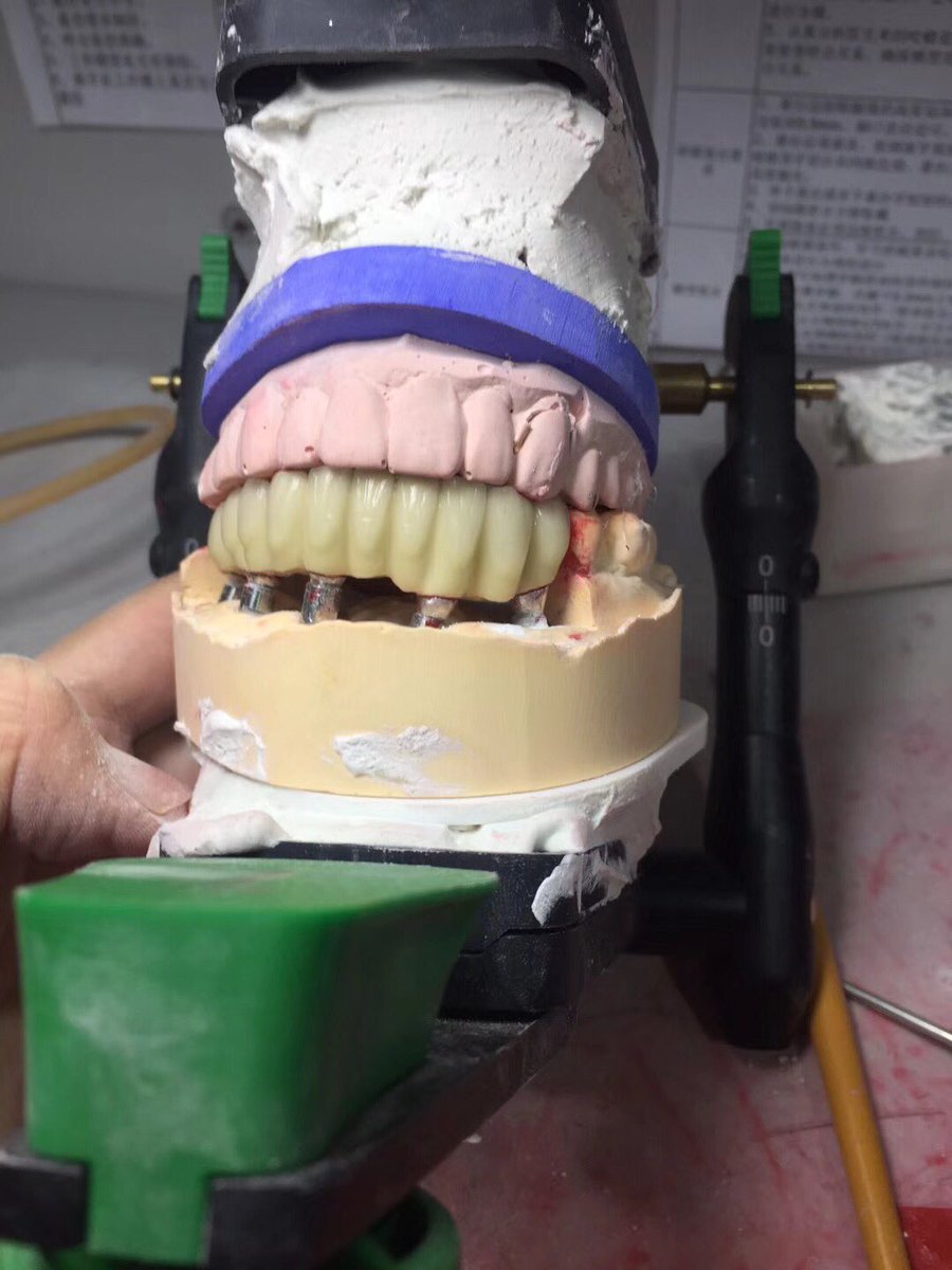 TOP Dental Lab (TOP_dentallab) Twitter
