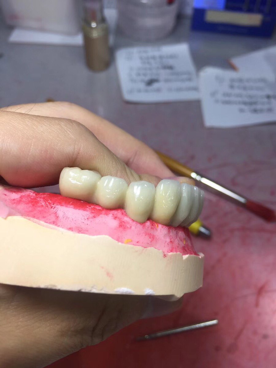 TOP Dental Lab (TOP_dentallab) Twitter