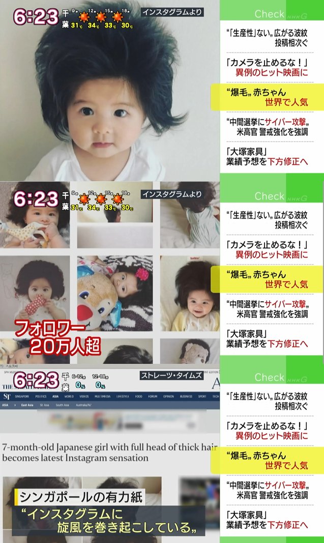 Twitter पर にこそく 爆毛 赤ちゃん 世界中で話題に 髪の毛がふさふさの赤ちゃんの写真がｓｎｓに投稿され そのかわいらしさが世界中で話題に Nhk めっちゃかわいい T Co Jklgmwoxlo