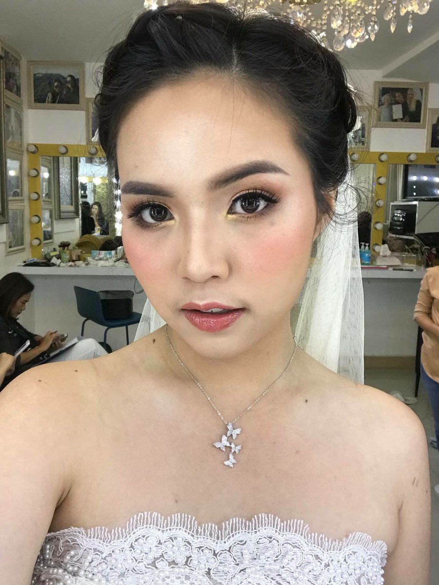 teddymakeup's tweet photo. EP.4 พอสุดท้ายฉีดครั้งที่สาม แต่อาจจะ 4 ถ้านับที่หมอ ฟอลโล่วเคสให้ อันนี้คือหน้าที่มันเริ่มกลับมา เราก็ไปฉีดซ้ำ มันก็เรียวได้ประมาณนี้เลย และตอนนี้เรารอมันกลับมาและมันก็กลับมาช้ามากยังไม่ขึ้นเลย ว่าจะไปลิฟท์หน้า เอามารีวิวแต่ทั้งนี้ต้องศึกษาข้อมูล คลีนิคให้แน่นอนก่อนเด้อ https://t.co/2fcaV6yorI